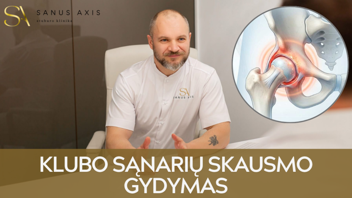 klubo-sanariu-isvarzos-gydymas